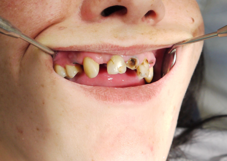 Первое обращение в стоматологию Денталюкс Рязань