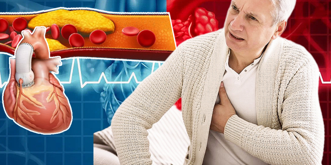 Два способа, как уберечь сердце и сосуды от инфаркта, о которых мало кто знает
