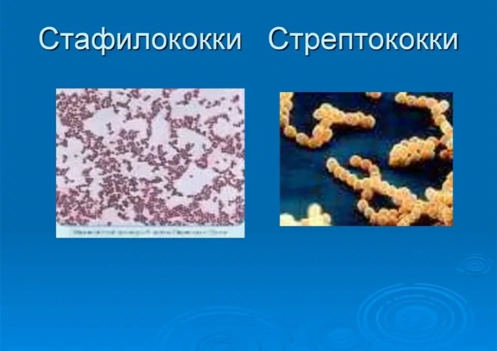 Стафилококки и Стрептококки.