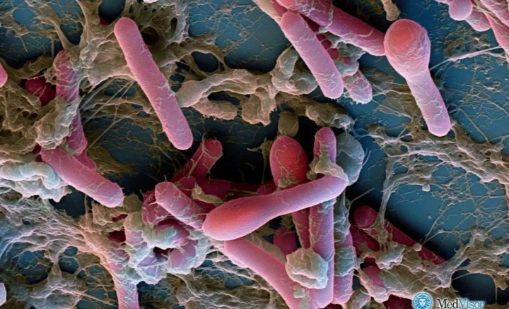 Clostridium botulinum.