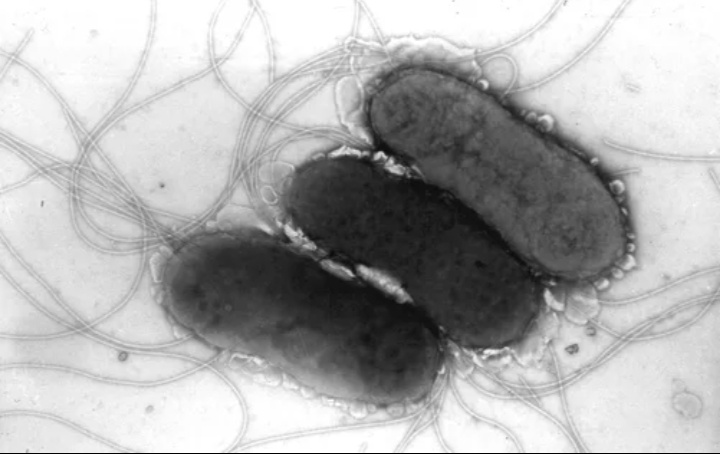 Сальмонелла под микроскопом.