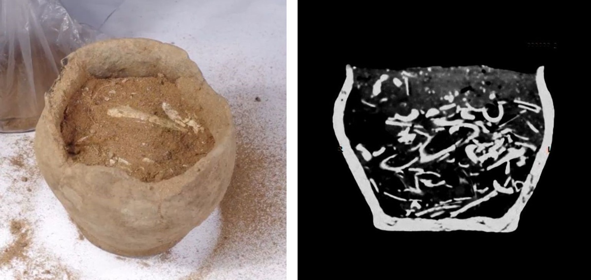 Слева: погребальная урна перед разбором. Справа: кадр компьютерной томограммы погребальной урны