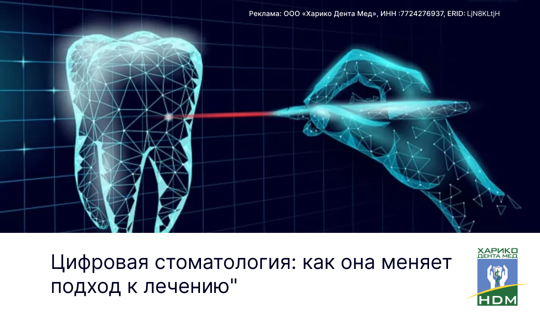 Реклама: OOO «Харико Дента Мед», ИНН :7724276937, ERID: LjN8KLtjH