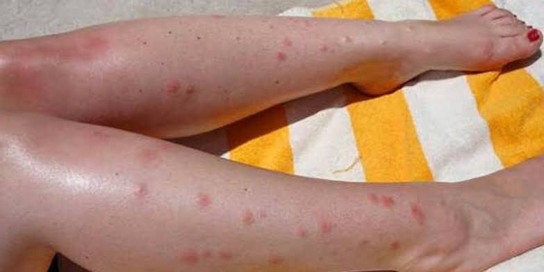 Не все на пляже ваши друзья.