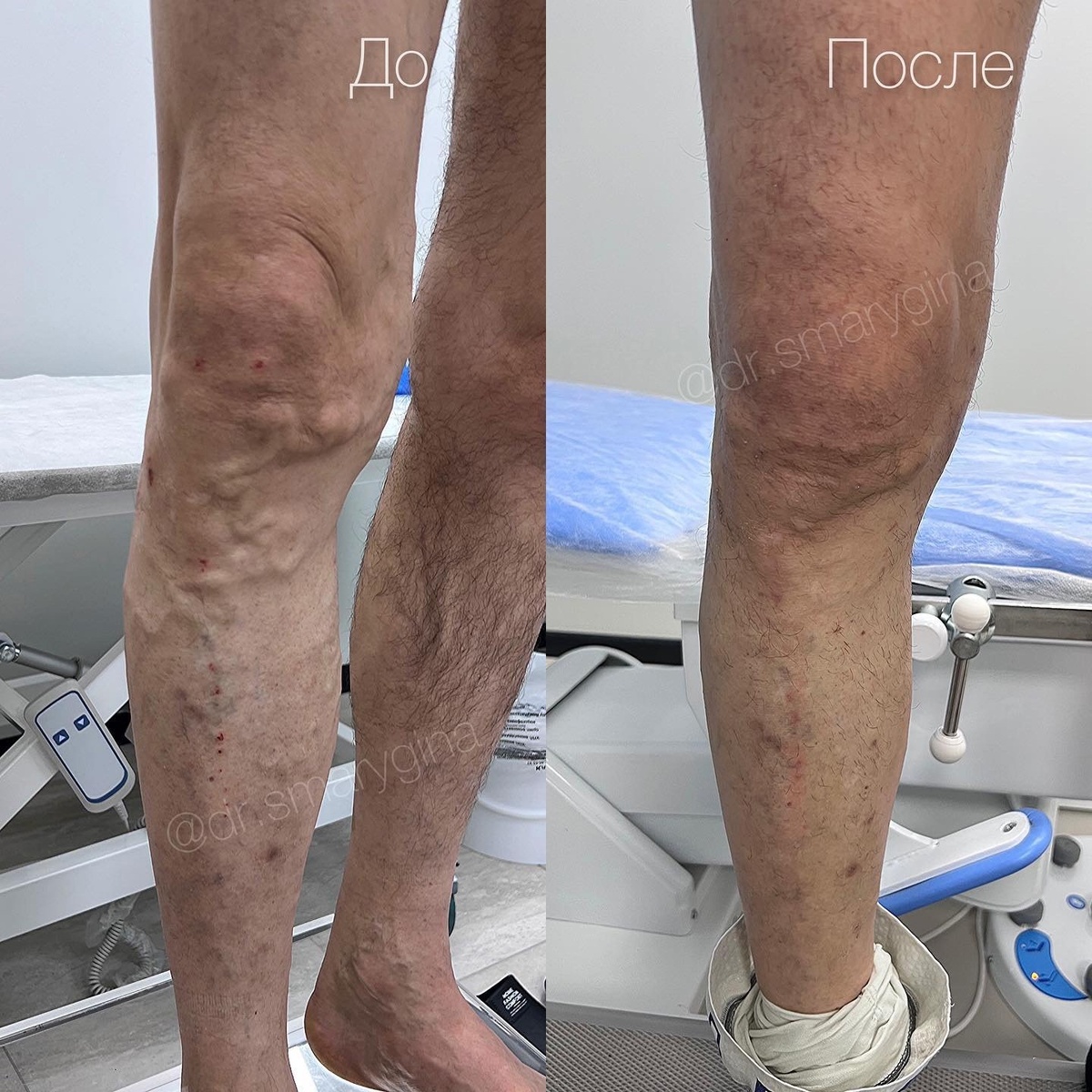 И вот такой прекрасный результат у теперь уже здорового человека!