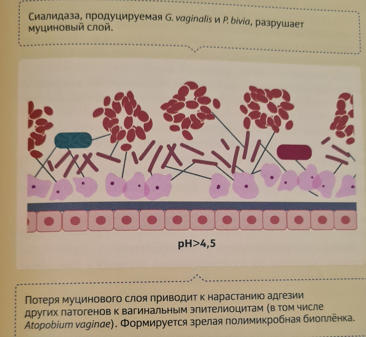 Иллюстрации цит. по "Биоценоз влагалища. Норма. Нарушения. Восстановление." , ред. Радзинского, Савичевой