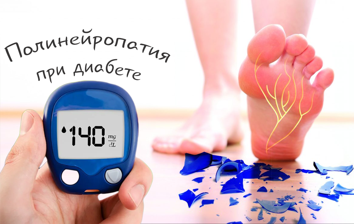 Когда диабет бьет по нервам. Полинейропатия при диабете: симптомы, лечение и профилактика