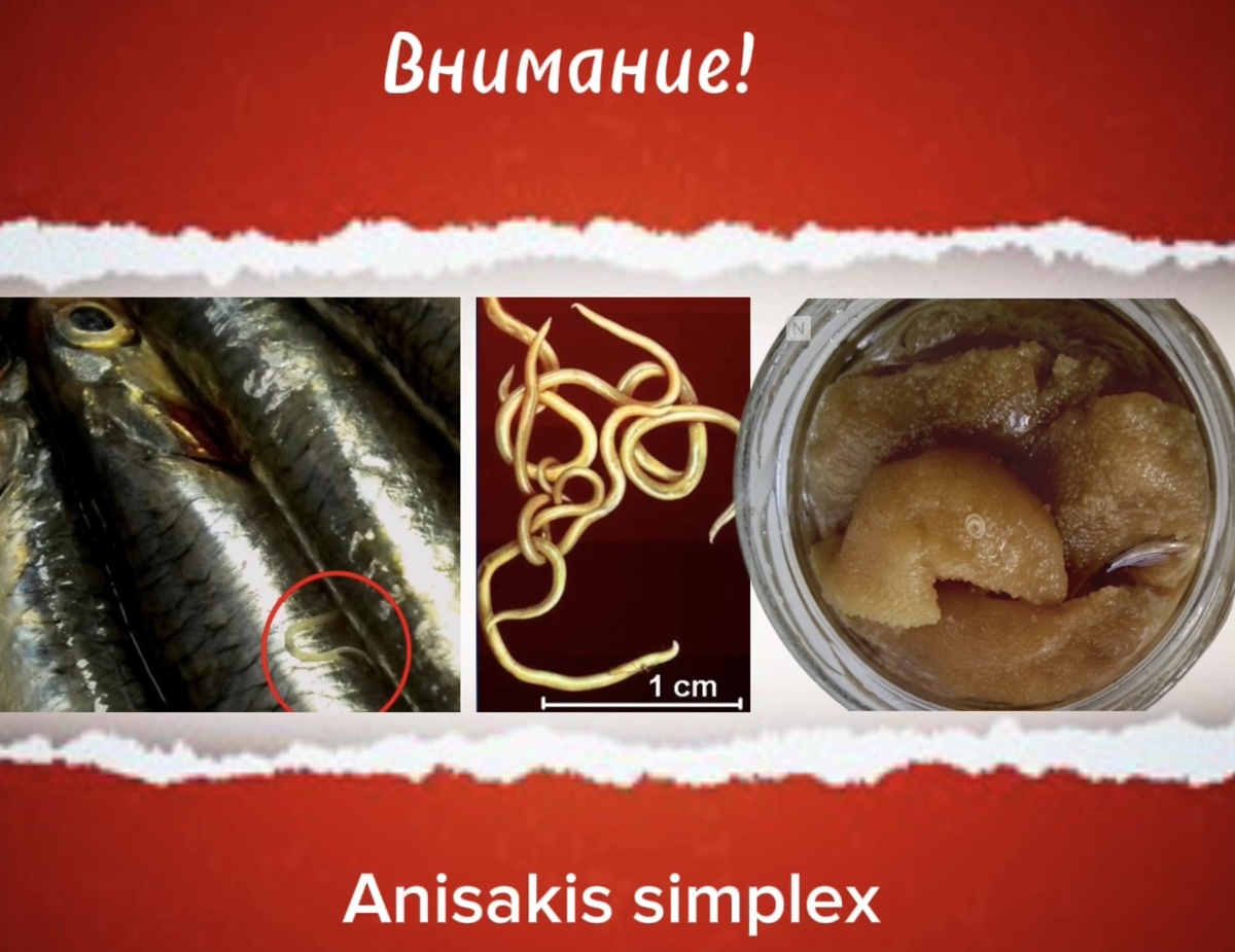 Самый частый паразит в селёдке