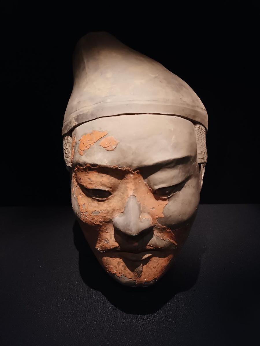 Пигментное пятно
