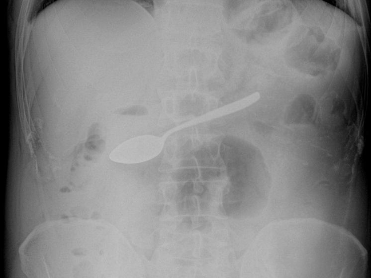 Фото: t.me/mgkb_med