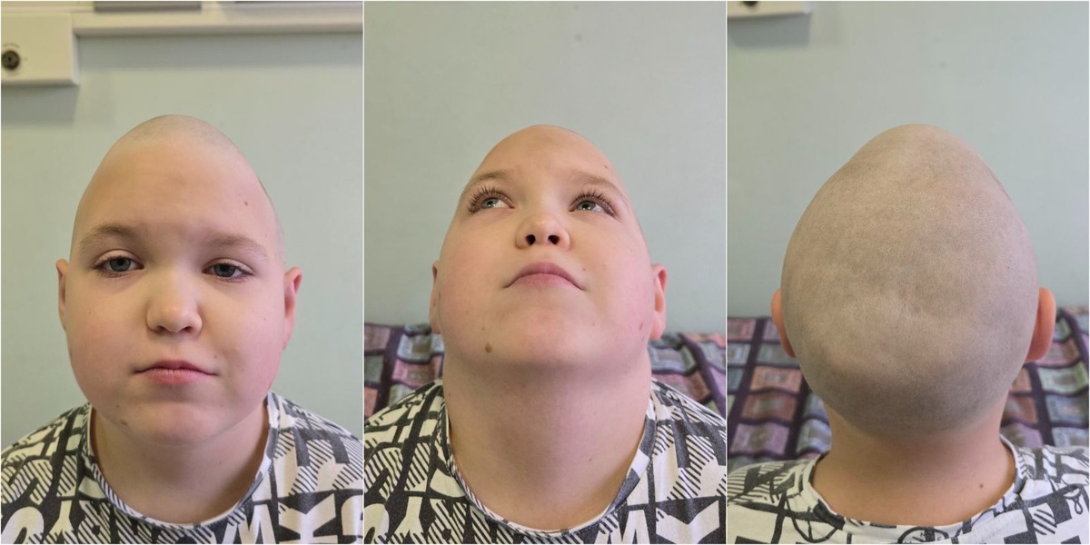 Иван ДО операции