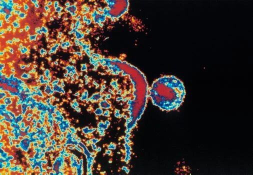    Фото: Custom Medical Stock Photo