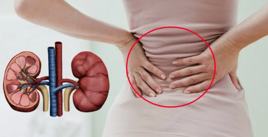 Симптомы и признаки боли в почках у женщин