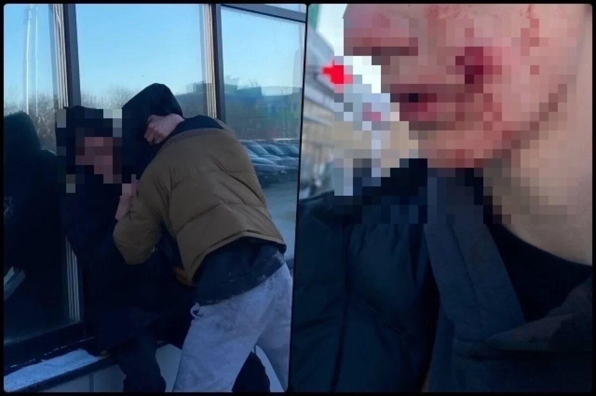    Бастрыкин потребовал возбудить дело о стрельбе в новосибирца из ракетницы