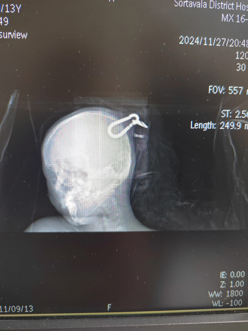    Глава Минздрава Карелии: "Мы молимся, чтобы у ребенка все было хорошо"со страницы главы Минздрава Карелии Михаила Охлопкова