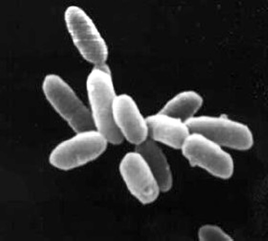 Археи  Halobacteria, штамм NRC-1 (ru.wikipedia.org)