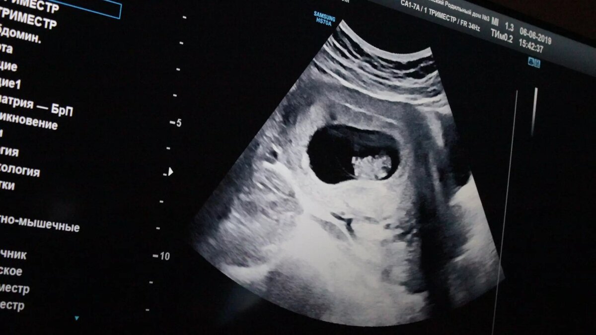     Источник: 1MI