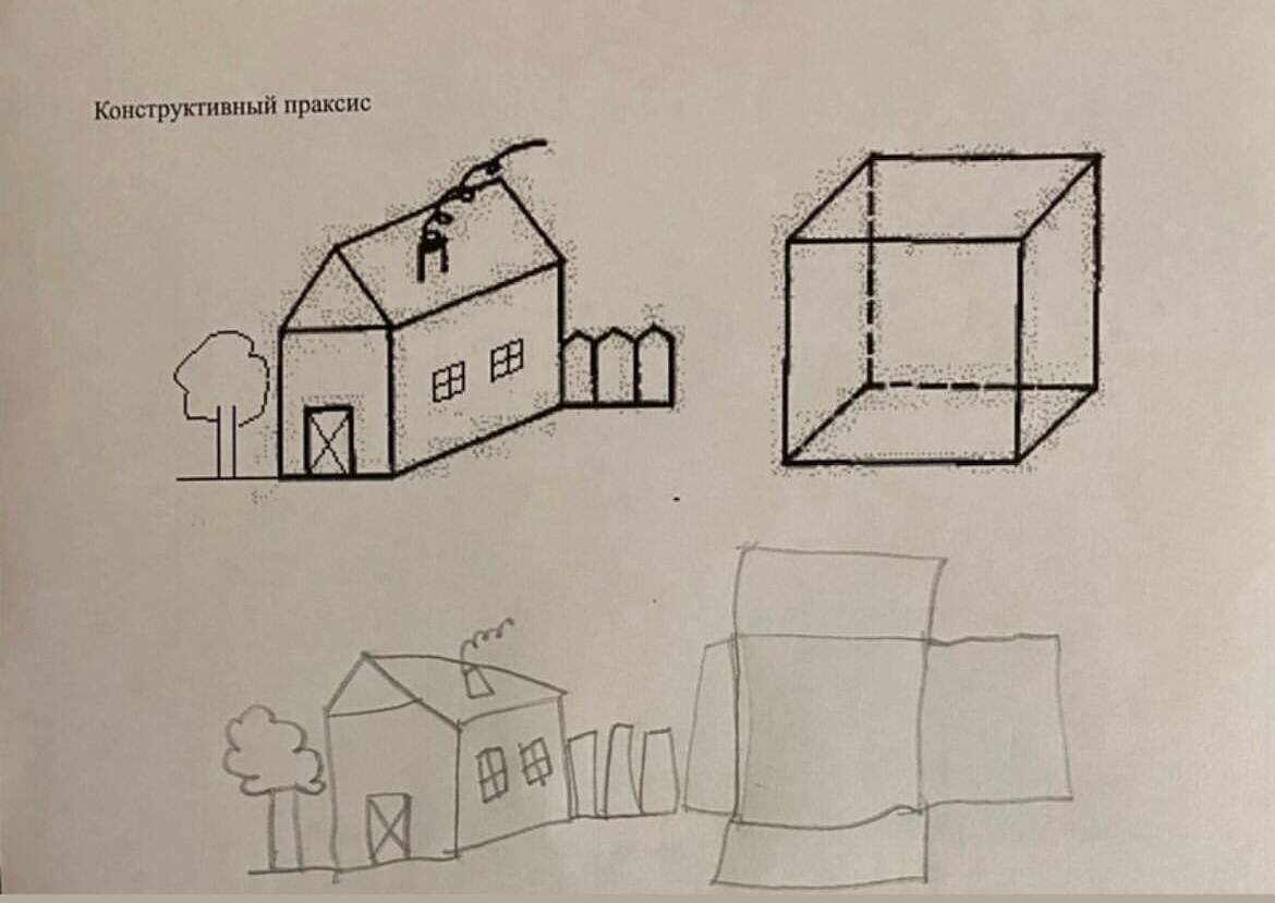 Копирование объемных изображений. Рисунок ребенка 7 лет. Переученный левша.