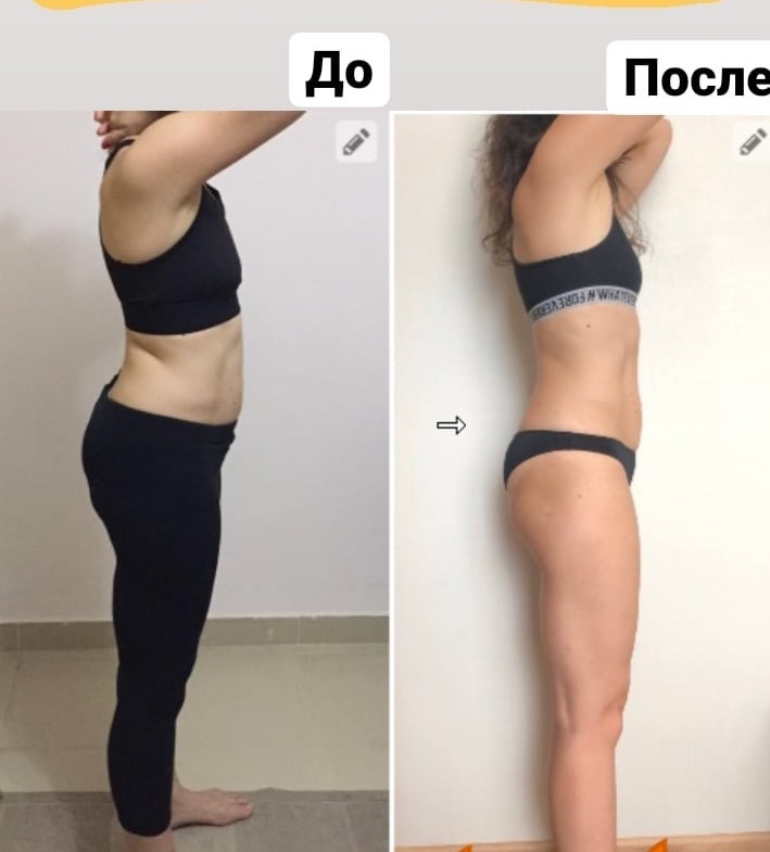 Фото с разрешения клиентки