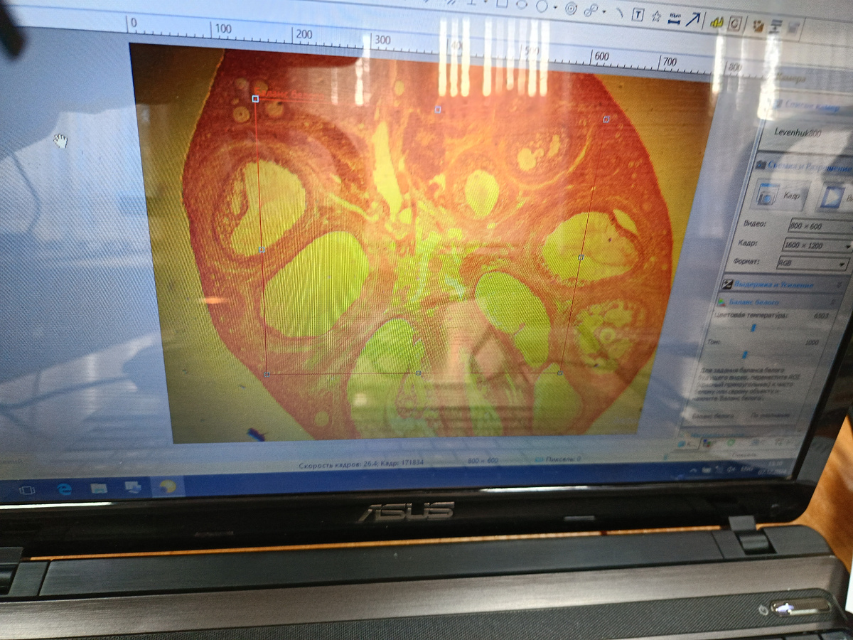 Просто красивая микроскопная фоточка. По-моему, это тыква.