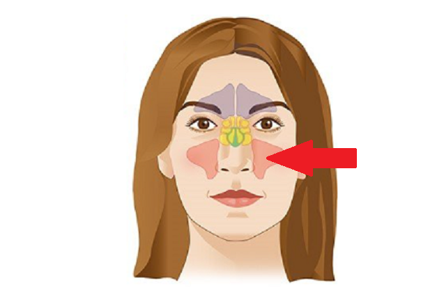 Стрелкой обозначена верхнечелюстная (Гайморова) пазуха