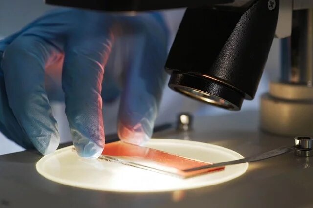    Что делать, если повышены тромбоциты в крови?