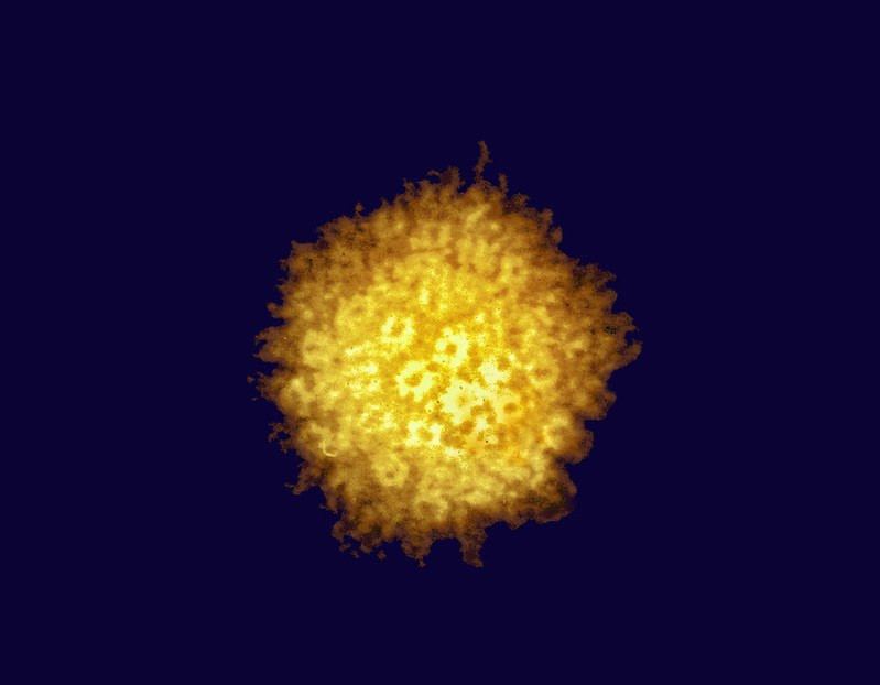 Цветная электронная микрофотография вируса простого герпеса (ВПГ).