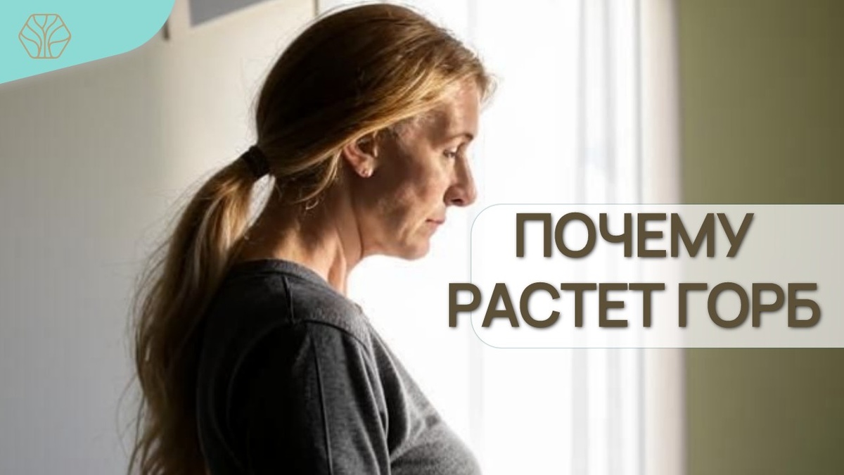 Чаще всего такое нарушение наблюдается у людей старше 45 лет. Важно понимать, что легче предотвратить образование горба, чем избавиться от него