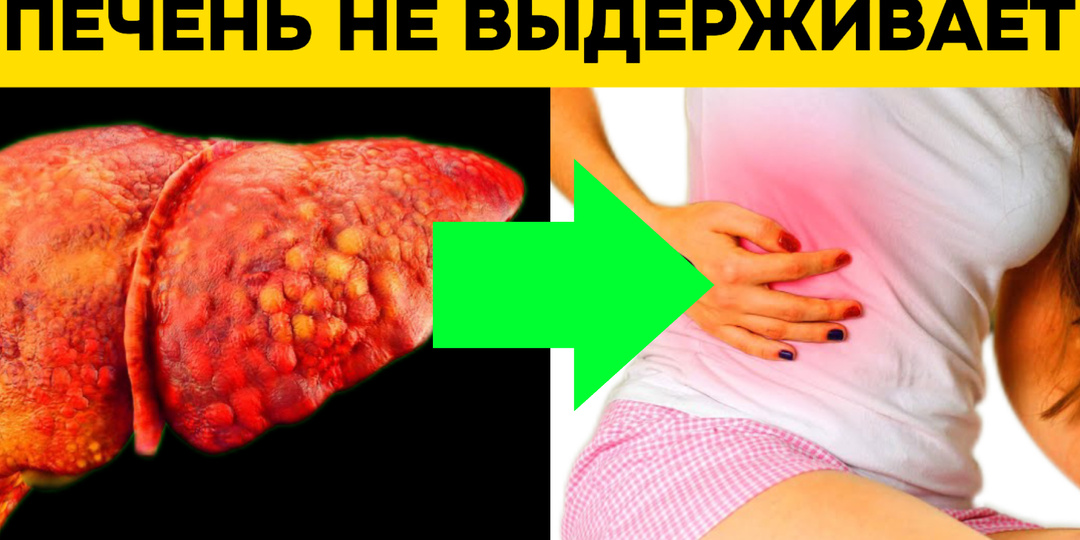 6 признаков того, что ваша печень больше не выдерживает вашего образа жизни