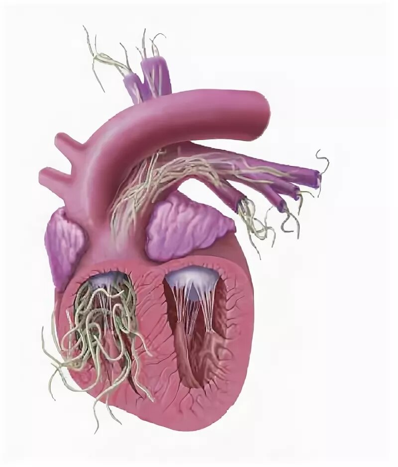 Картинка из интернета - взрослые особи дирофиляриоза в сердце
