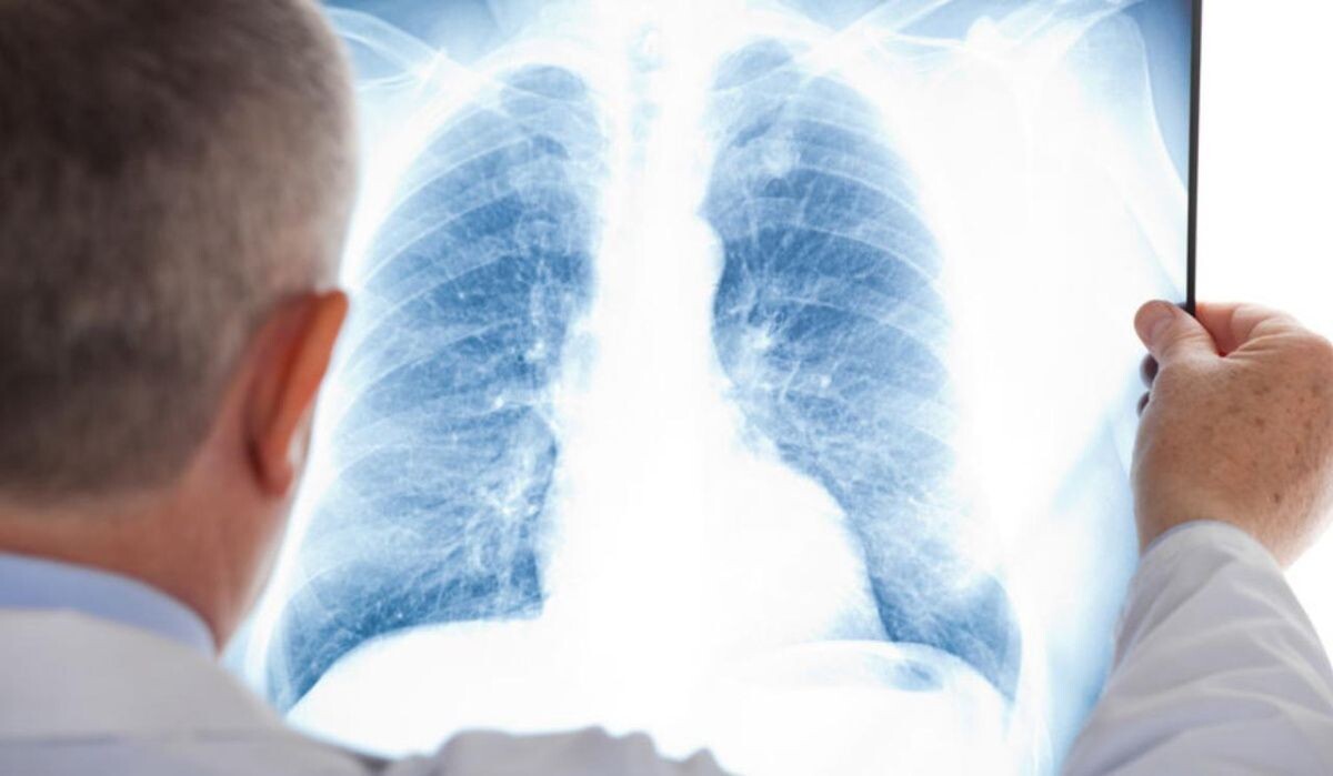     Врач смотрит снимки. Источник: gazeta.ru Автор фото: Михаил Синев