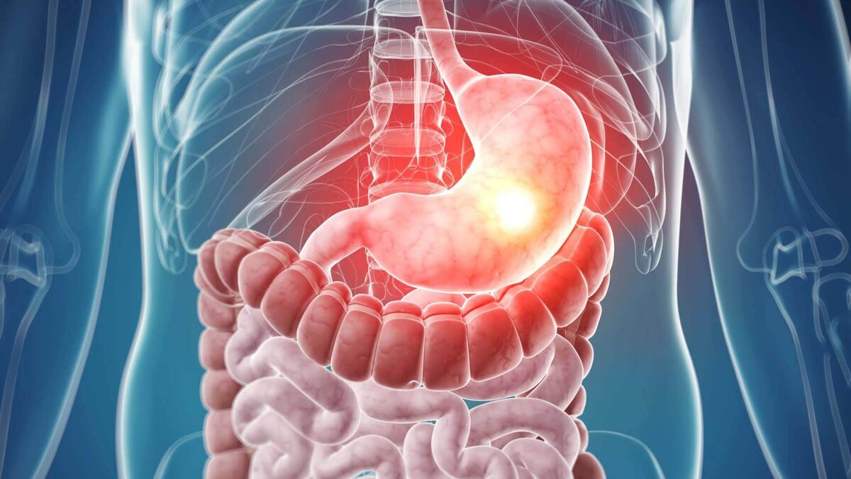    Желудок человека способен растягиваться и увеличиваться в объеме в несколько раз. Источник: 100med.ru