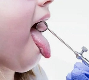 Лечение острого ларингита: особенности тактики