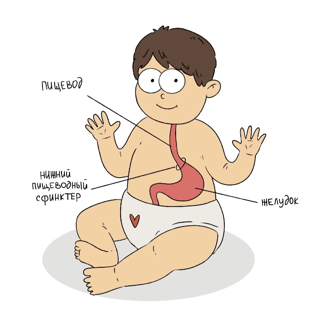 Основная причина срыгиваний у малышей: слабый нижний пищеводный сфинктер 