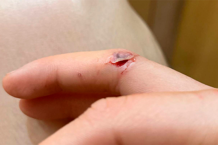    «Что касается меня, то на моих руках остались открытые раны от укуса булли».   
Фото: Мария Новикевич