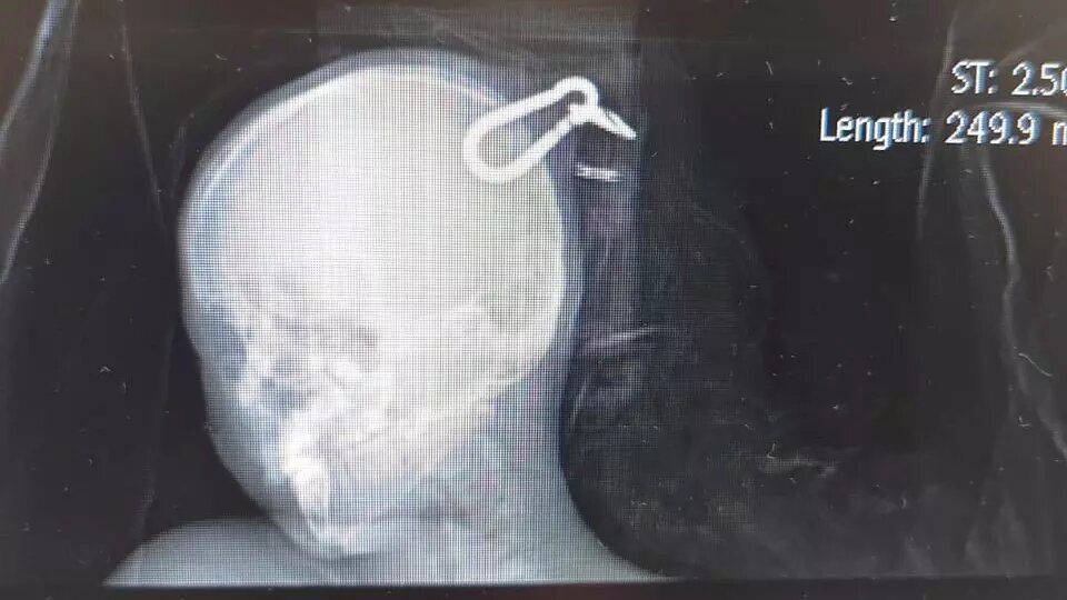     Источник: Минздрав РК