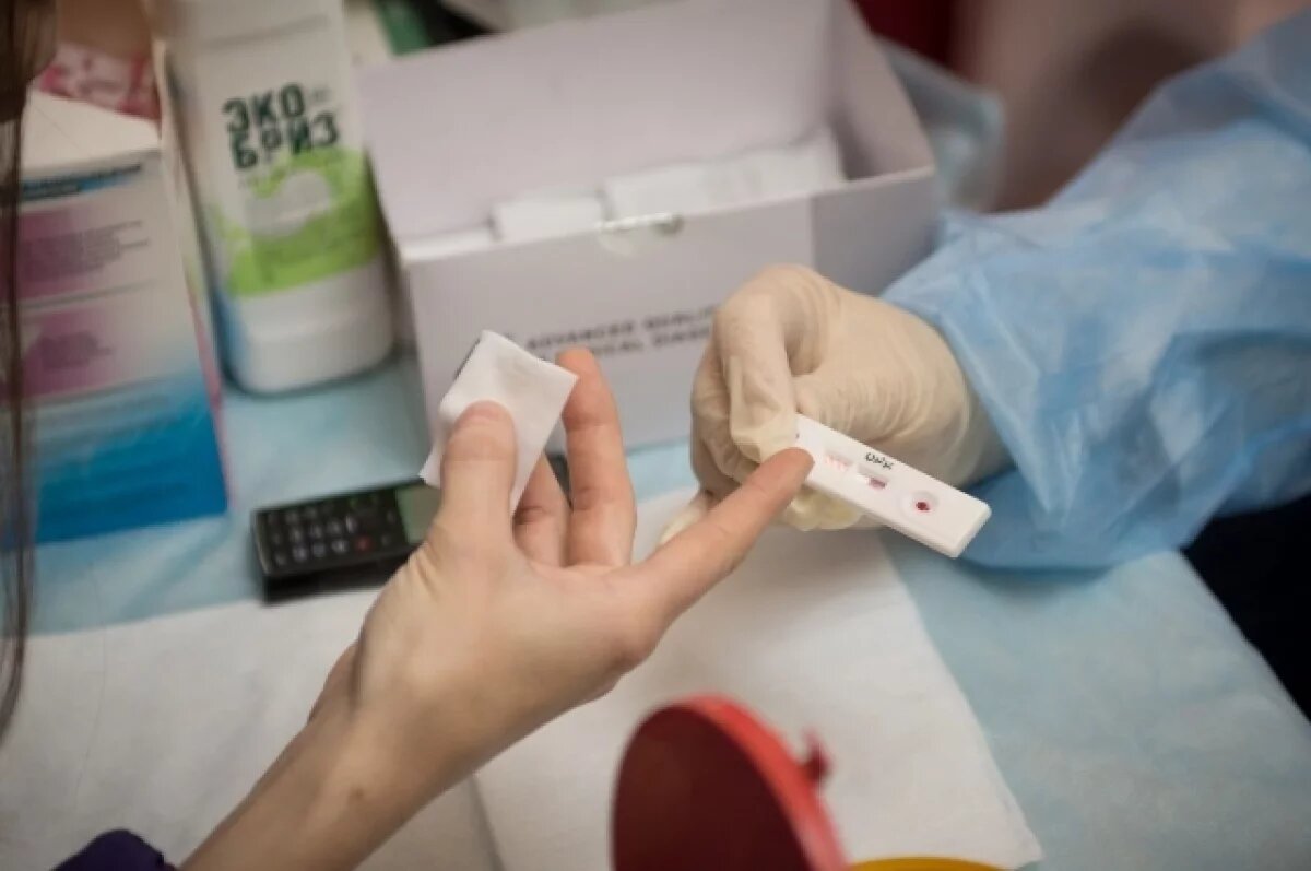    На 13% выросло число выявленных в Псковской области случаев ВИЧ за год