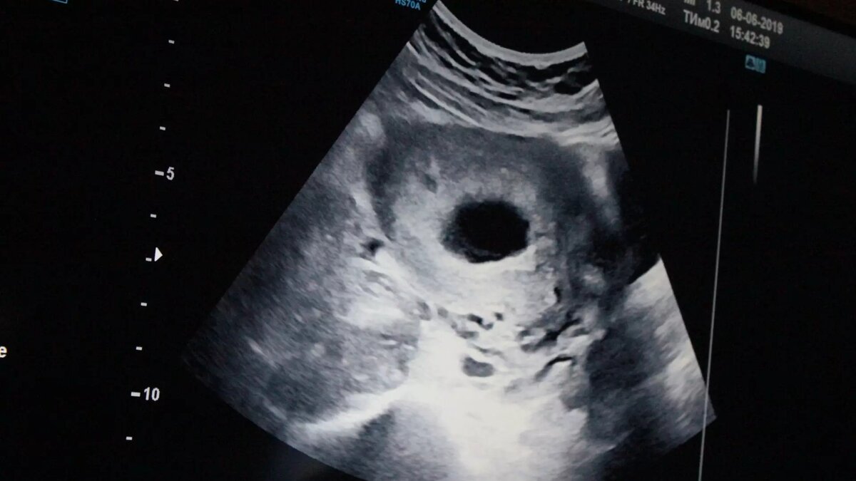     Источник: nashgorod.ru