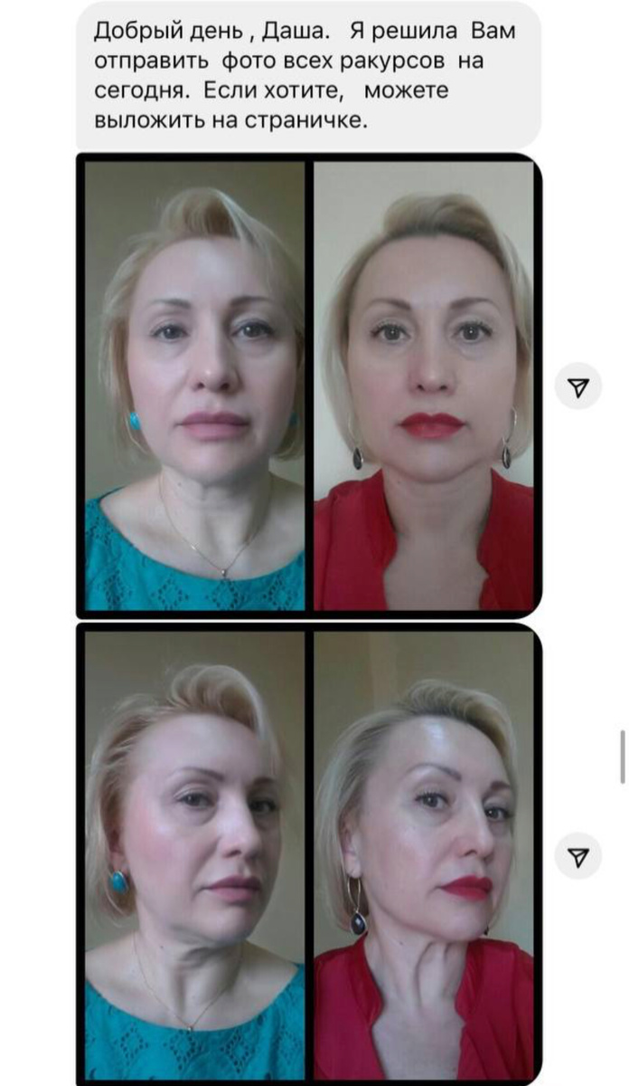 Фото ученицы до/после (разница 3 недели) 