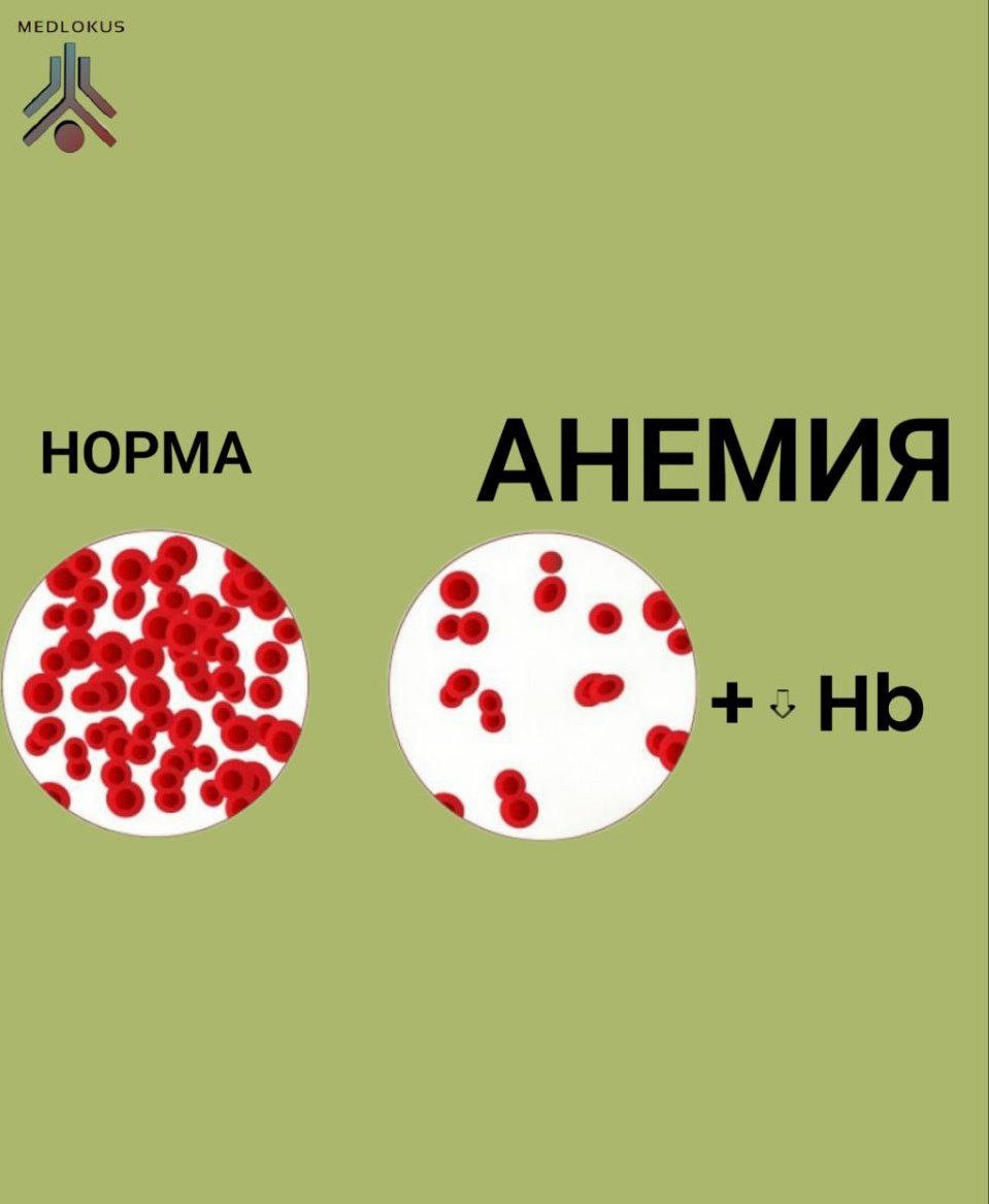В первом случае клеток в крови много. Во втором - мало, поэтому снижен гемоглобин.
