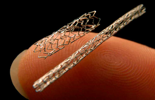 Неоправданная установка стентов встречается всё чаще