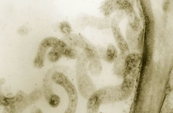 Микоплазменную пневмонию вызывают микроорганизмы. Фото © Wikipedia 