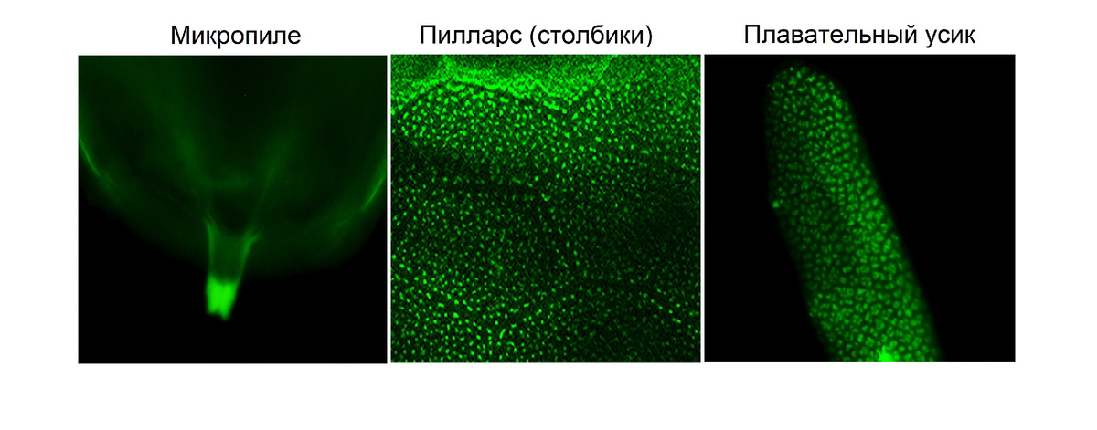 Накопление амилоида s36 в различных структурах оболочки яйца дрозофилы. Источник: Valina et al. / International Journal of Molecular Sciences, 2024