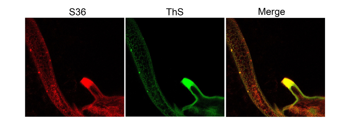 Окрашивание микропиле и плавательных усиков яиц дрозофилы антителами, узнающими s36 (красный), а также амилоид-специфичным красителем ThS (зеленый). Желтый сигнал (merge) свидетельствует о совпадении красного и зеленого сигналов. Источник: Valina et al. / International Journal of Molecular Sciences, 2024