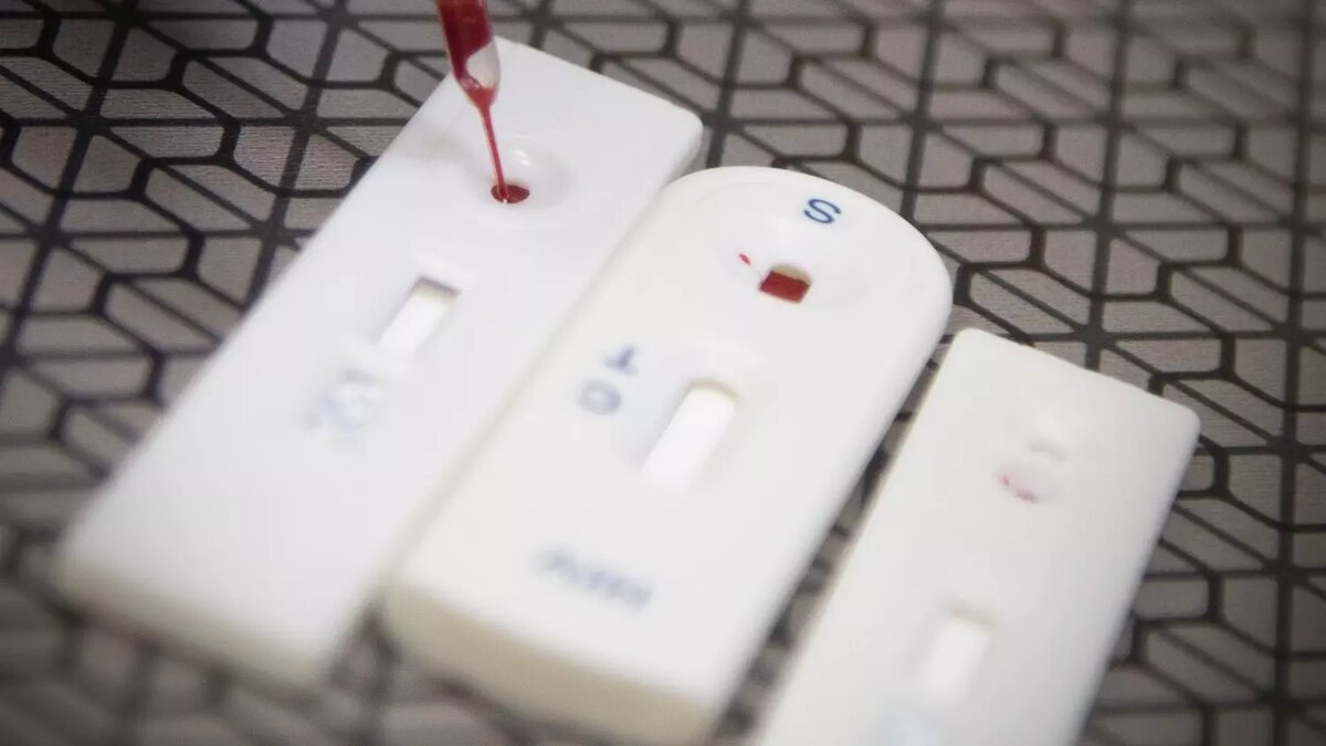 Лекарства, которое могло бы полностью избавить от ВИЧ, в настоящее время не существует. Фото: Артур Салимов. 1MI