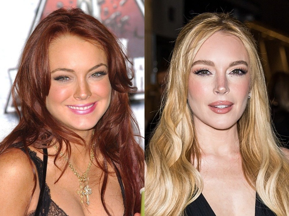    Линдси Лохан в 2004 году (слева) и в 2024 году (справа)