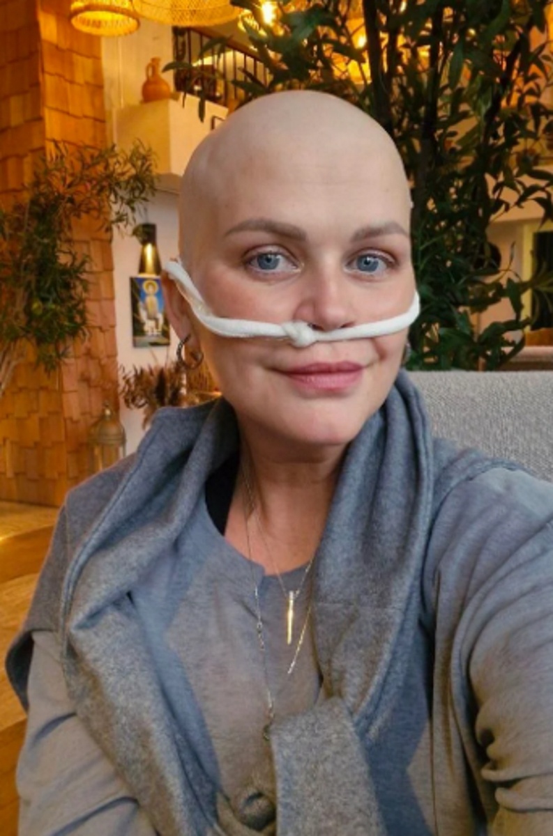 Сабина Пантус призналась, что может есть только мягкую пищу. Фото: соцсети