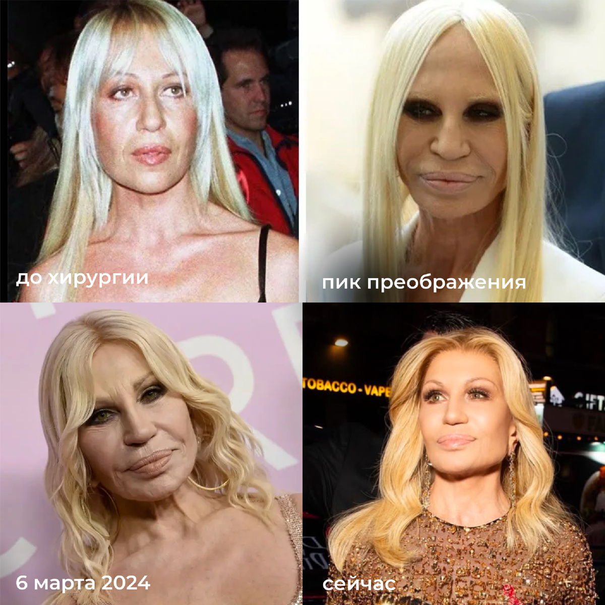 Донателла Версаче до/ после хиругии / после окончательного преображения ноябрь 2024