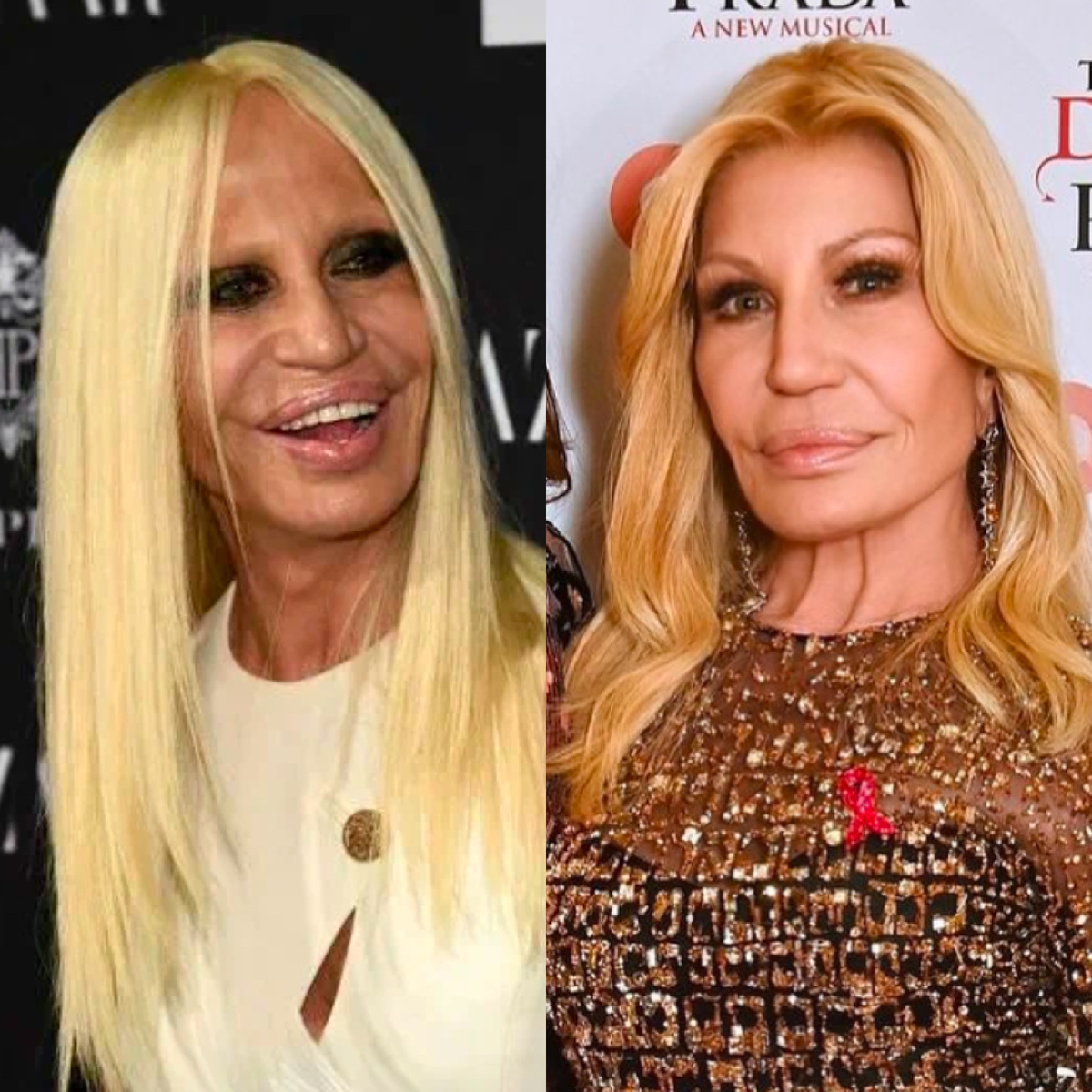 Донателла Версаче до и после преображения ноябрь 2024