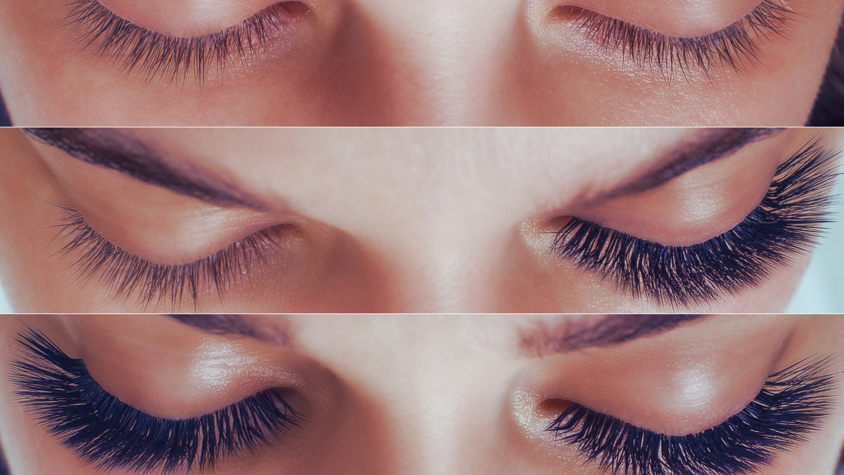 Фото "до и после" процедуры 